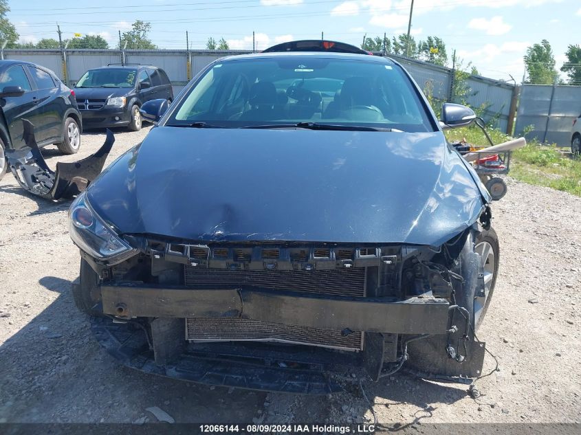 2017 Hyundai Elantra Limited VIN: KMHD84LF4HU221117 Lot: 12066144