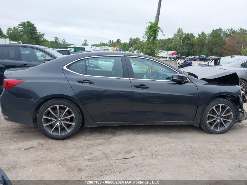 19UUB3F5XFA803774 2015 Acura Tlx