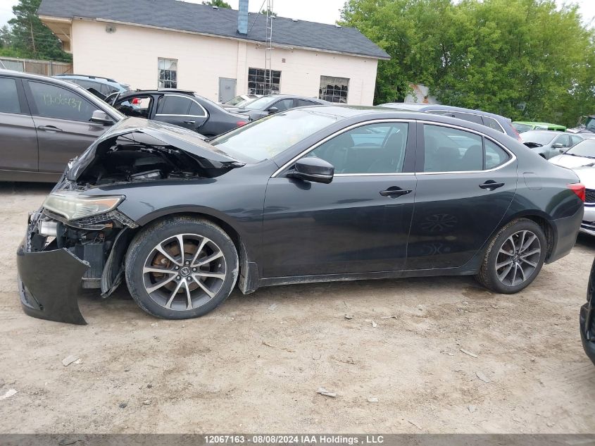 19UUB3F5XFA803774 2015 Acura Tlx