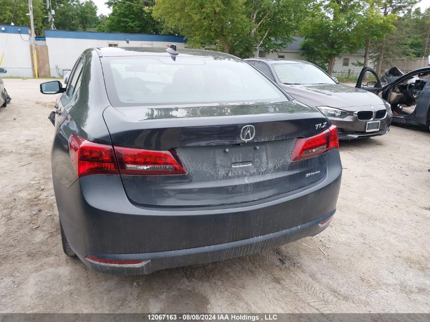 19UUB3F5XFA803774 2015 Acura Tlx