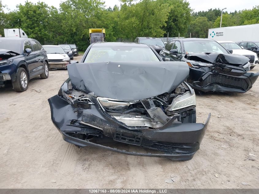 19UUB3F5XFA803774 2015 Acura Tlx