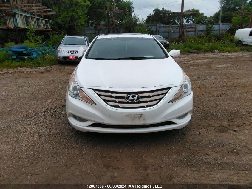 2013 Hyundai Sonata Gls VIN: 5NPEB4AC4DH564551 Lot: 12067386