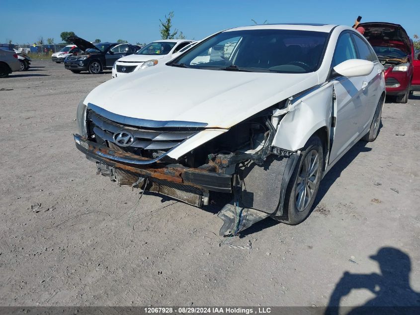 5NPEB4AC4DH670630 2013 Hyundai Sonata Gls