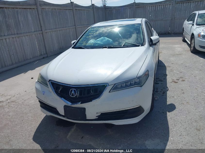 2015 Acura Tlx VIN: 19UUB3F55FA804105 Lot: 12068384