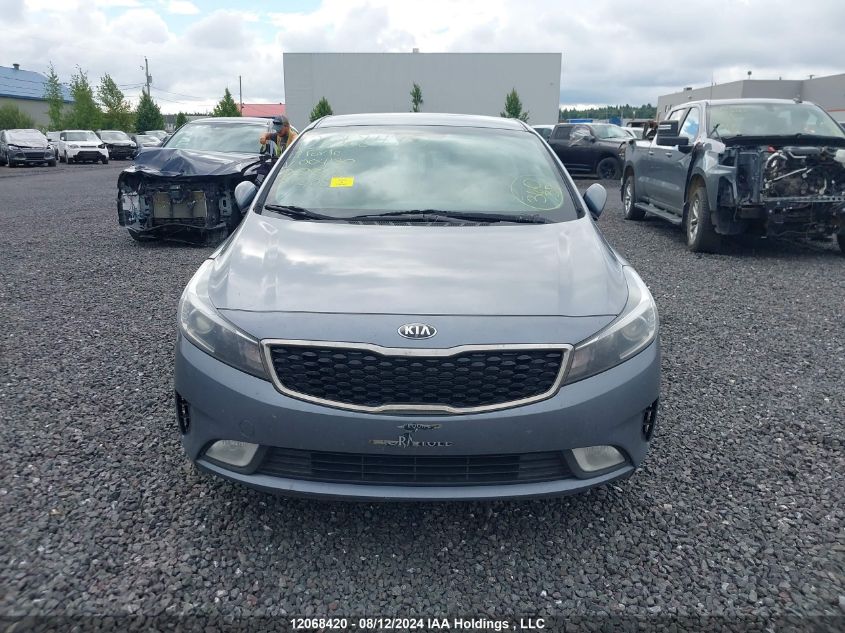 2017 Kia Forte VIN: 3KPFL4A89HE004130 Lot: 12068420