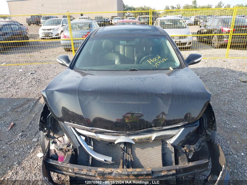 2013 Hyundai Sonata Se/Limited VIN: 5NPEC4AC7DH700149 Lot: 12070582