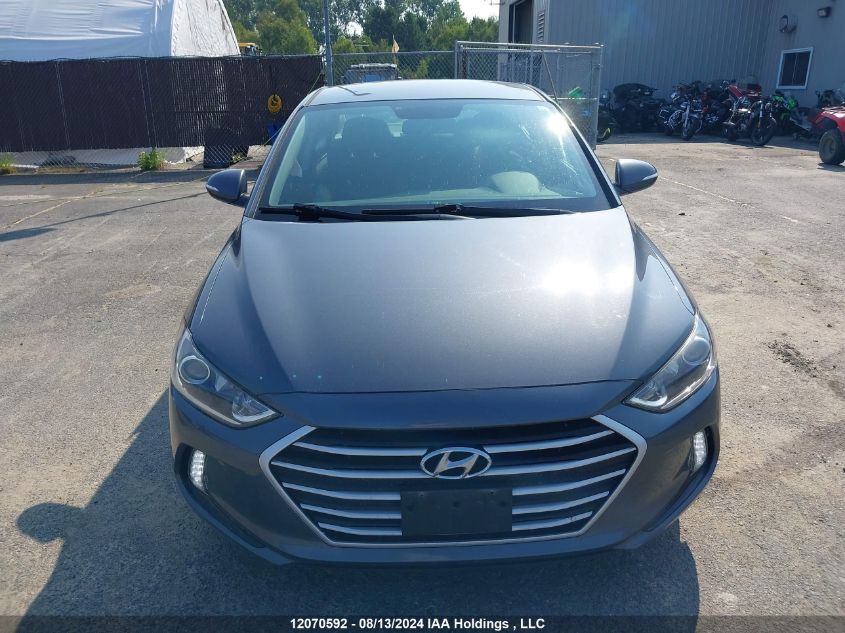 KMHD84LF4JU695526 2018 Hyundai Elantra Sel/Value/Limited