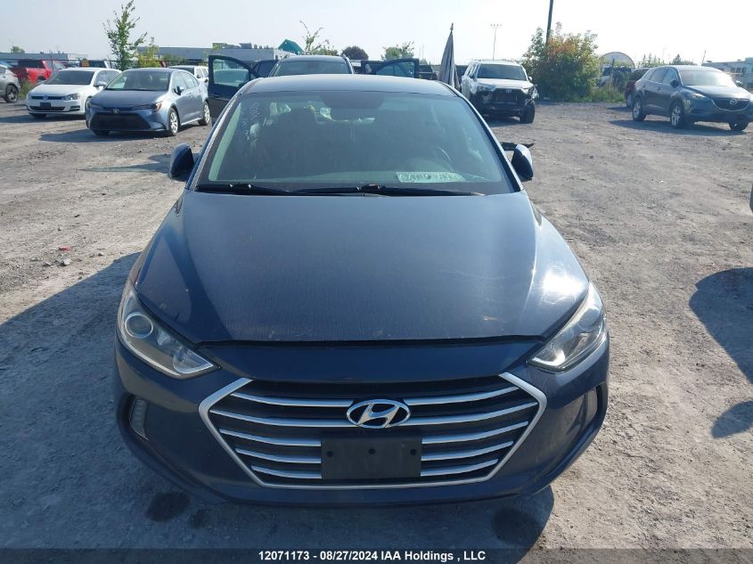 2017 Hyundai Elantra Gl VIN: KMHD84LF4HU114746 Lot: 12071173