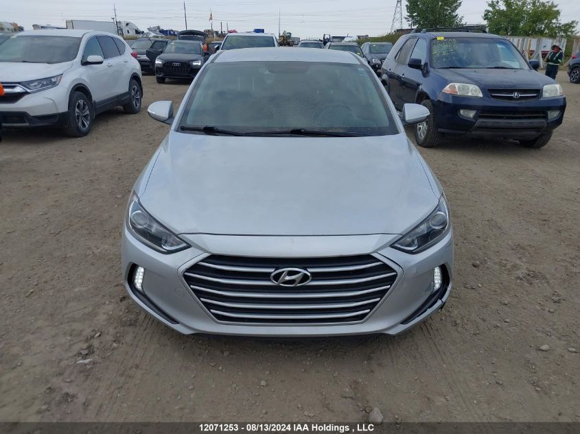 2017 Hyundai Elantra Se/Value/Limited VIN: KMHD84LF3HU398550 Lot: 12071253