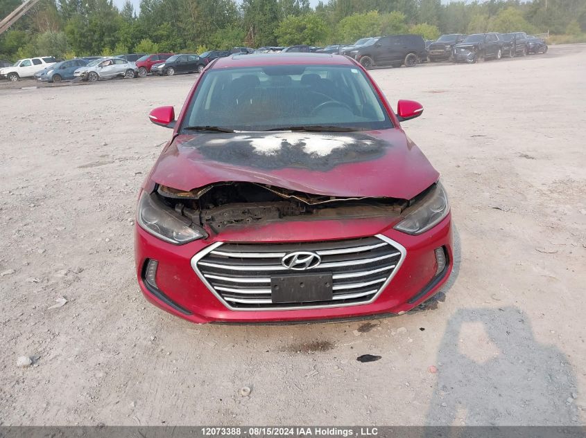 2017 Hyundai Elantra Se/Value/Limited VIN: KMHD84LF7HU267668 Lot: 12073388