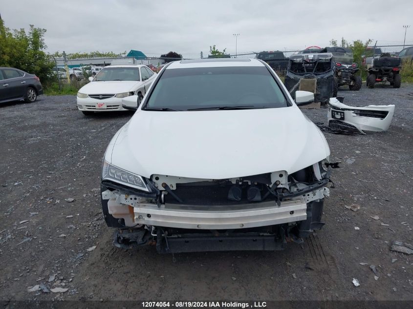 2015 Acura Tlx Tech VIN: 19UUB1F5XFA800846 Lot: 12074054