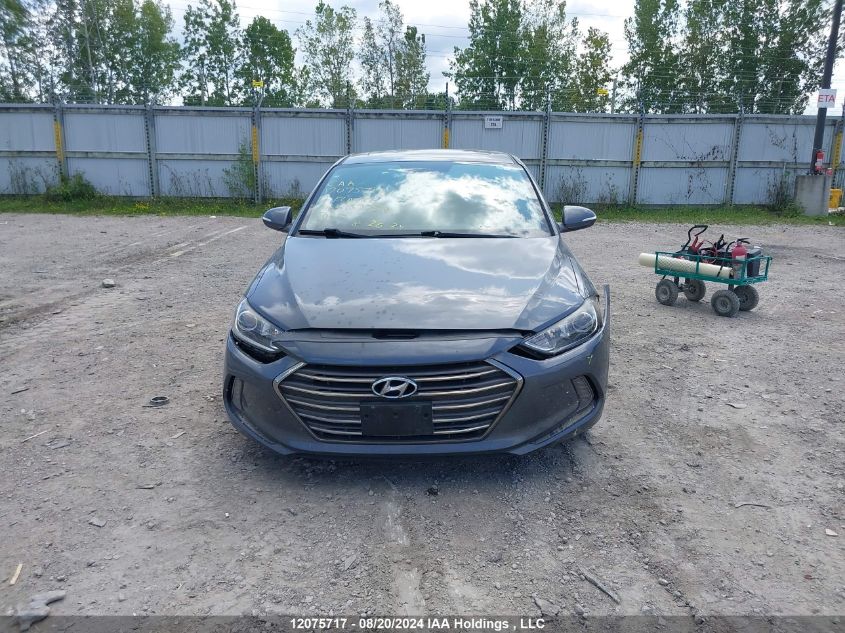 2017 Hyundai Elantra Limited VIN: KMHD84LF5HU137758 Lot: 12075717