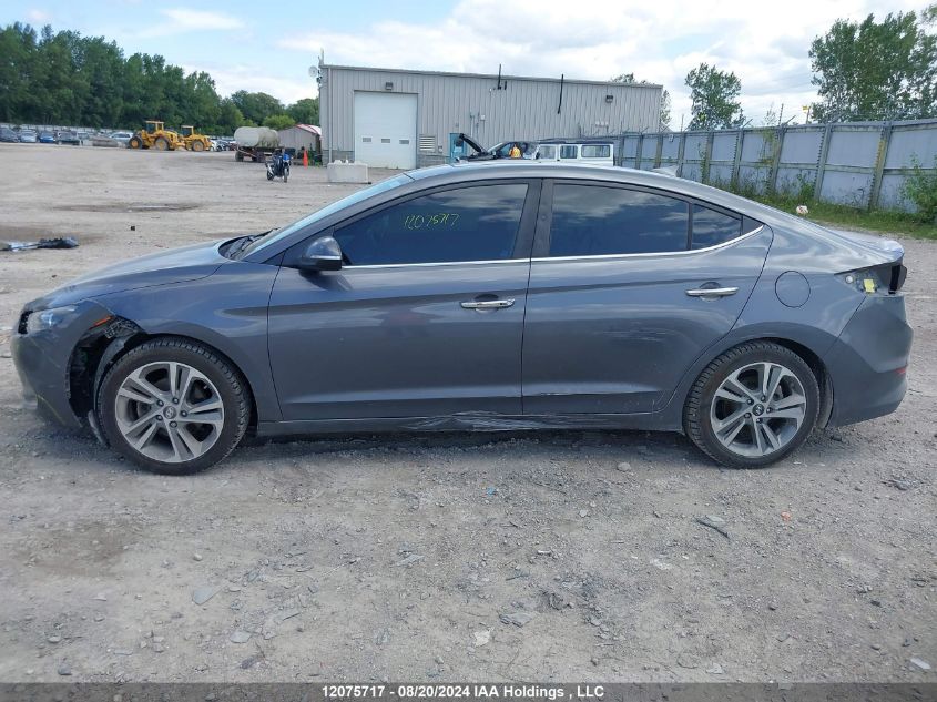 2017 Hyundai Elantra Limited VIN: KMHD84LF5HU137758 Lot: 12075717