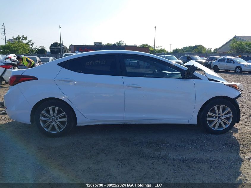 KMHDH4AE7FU388370 2015 Hyundai Elantra Se/Sport/Limited