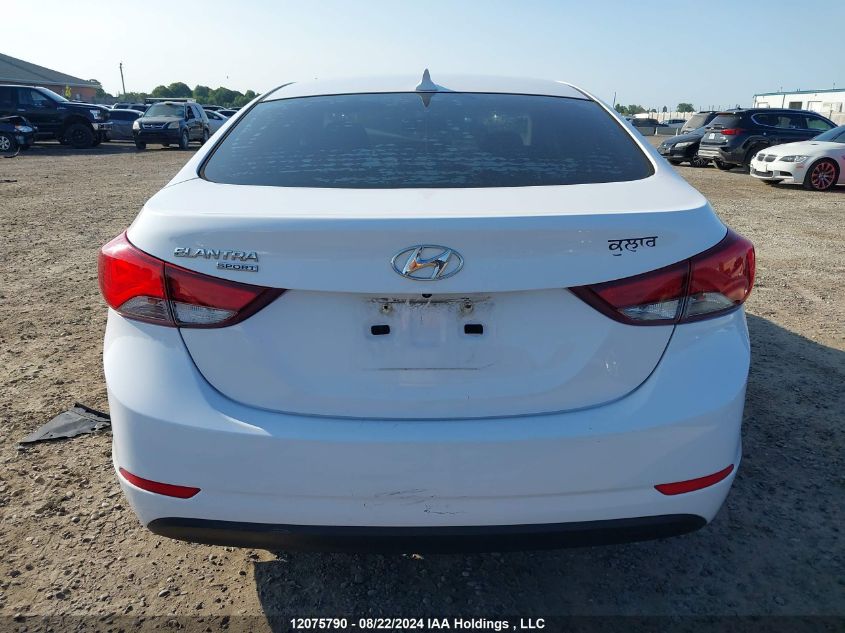 KMHDH4AE7FU388370 2015 Hyundai Elantra Se/Sport/Limited