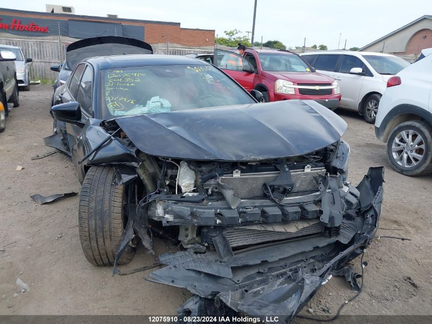 2021 Acura Tlx Tech A VIN: 19UUB6F59MA801352 Lot: 12075910