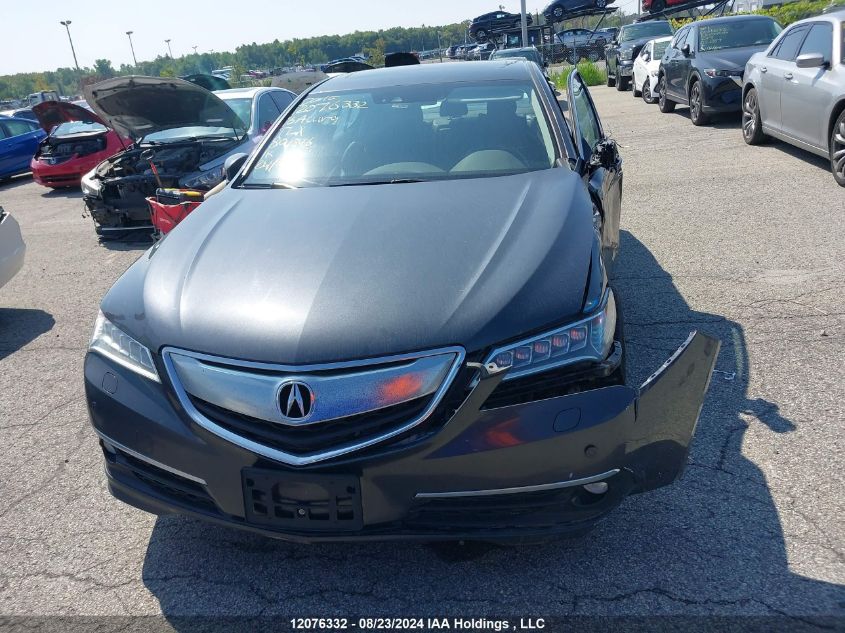 2016 Acura Tlx VIN: 19UUB3F76GA801846 Lot: 12076332