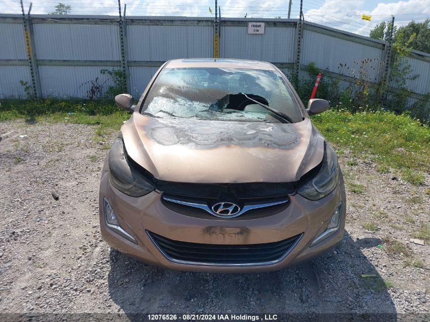 2016 Hyundai Elantra Se/Sport/Limited VIN: KMHDH4AE2GU570723 Lot: 12076526