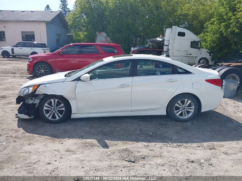 5NPEB4AC5EH926372 2014 Hyundai Sonata Gls