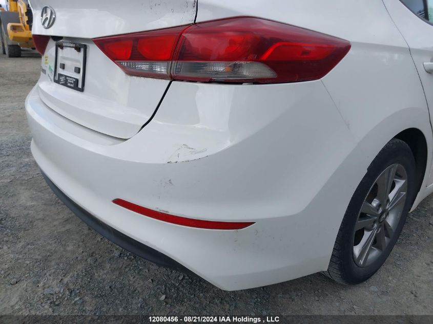 KMHD84LF2JU621523 2018 Hyundai Elantra Sel/Value/Limited