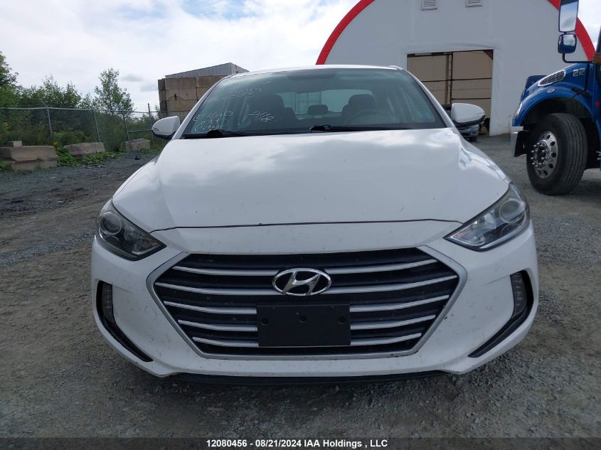 KMHD84LF2JU621523 2018 Hyundai Elantra Sel/Value/Limited