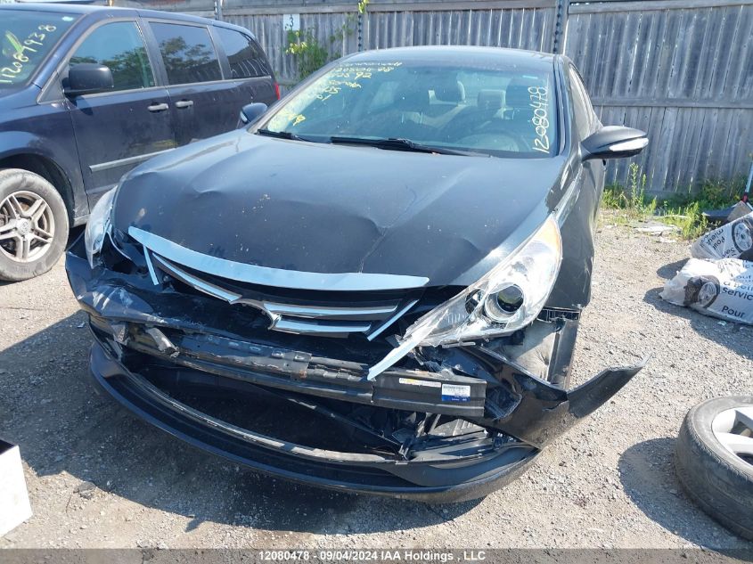 5NPEB4AC8EH812592 2014 Hyundai Sonata Gls