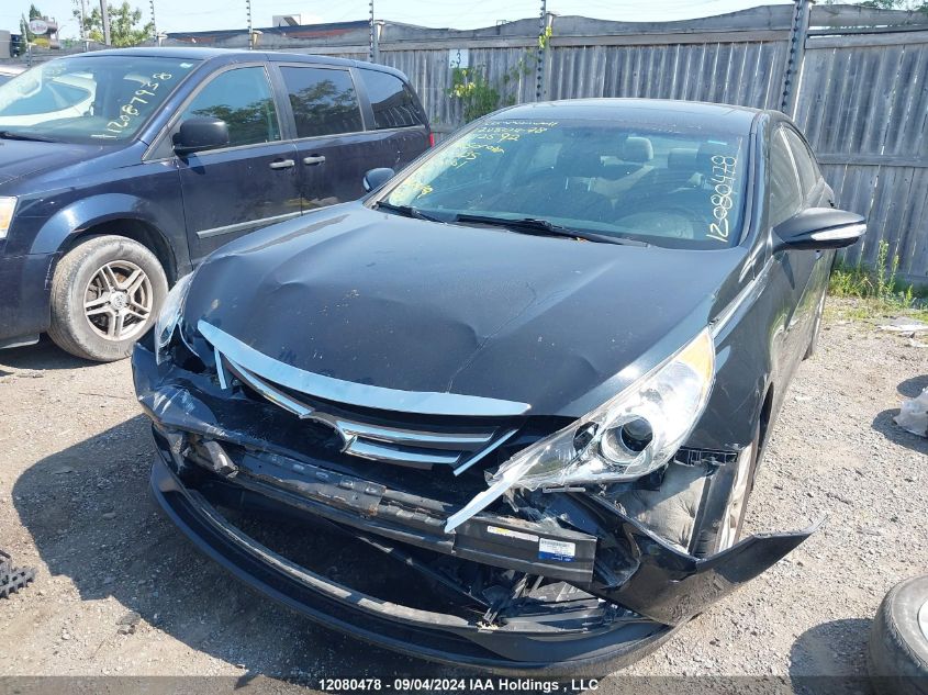 5NPEB4AC8EH812592 2014 Hyundai Sonata Gls