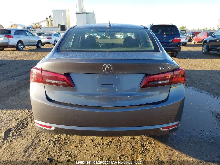 2017 Acura Tlx VIN: 19UUB1F54HA800263 Lot: 12083196