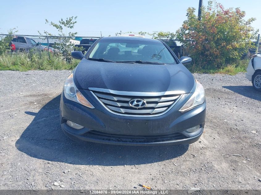 2013 Hyundai Sonata Se/Limited VIN: 5NPEC4AC5DH607257 Lot: 12084876