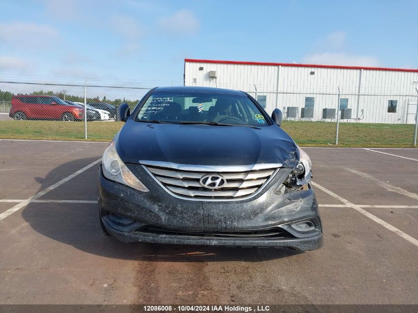 5NPEB4AC2DH623080 2013 Hyundai Sonata Gls