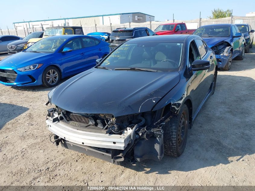 19UUB3F55GA802050 2016 Acura Tlx