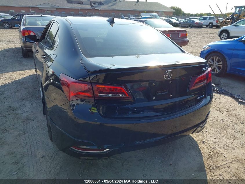 19UUB3F55GA802050 2016 Acura Tlx