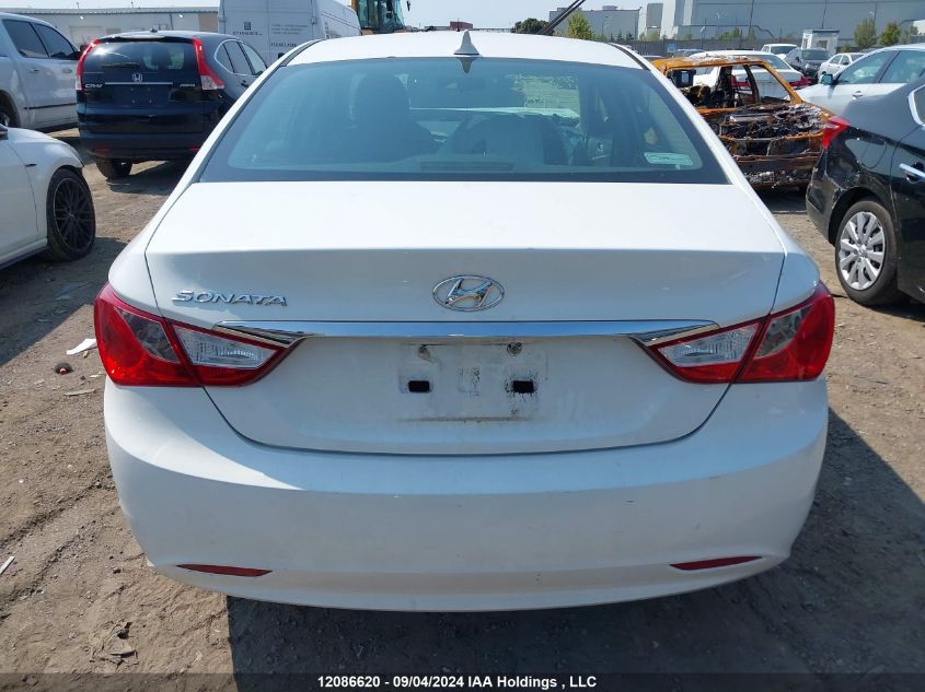 2011 Hyundai Sonata Gls VIN: 5NPEB4AC8BH004027 Lot: 12086620