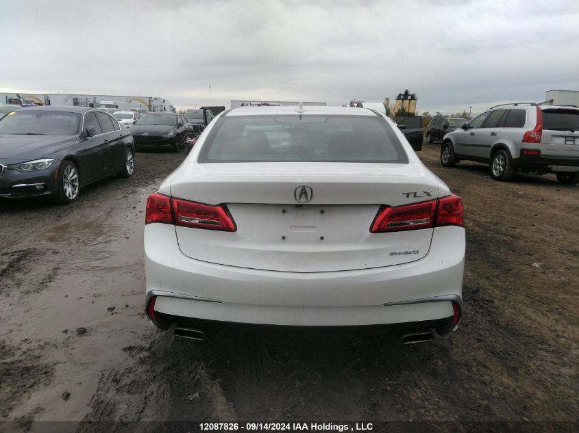 2018 Acura Tlx VIN: 19UUB3F30JA800907 Lot: 12087826