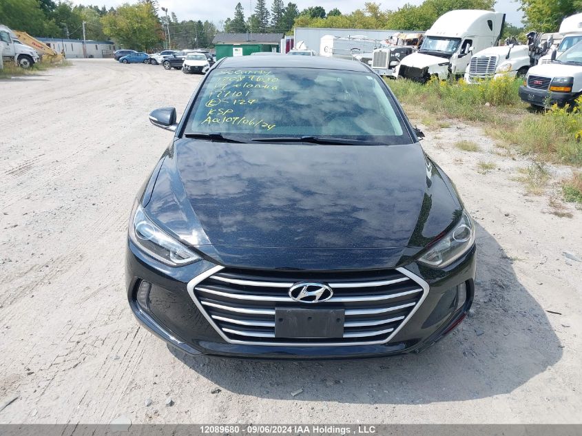 KMHD84LF9HU177101 2017 Hyundai Elantra Gl