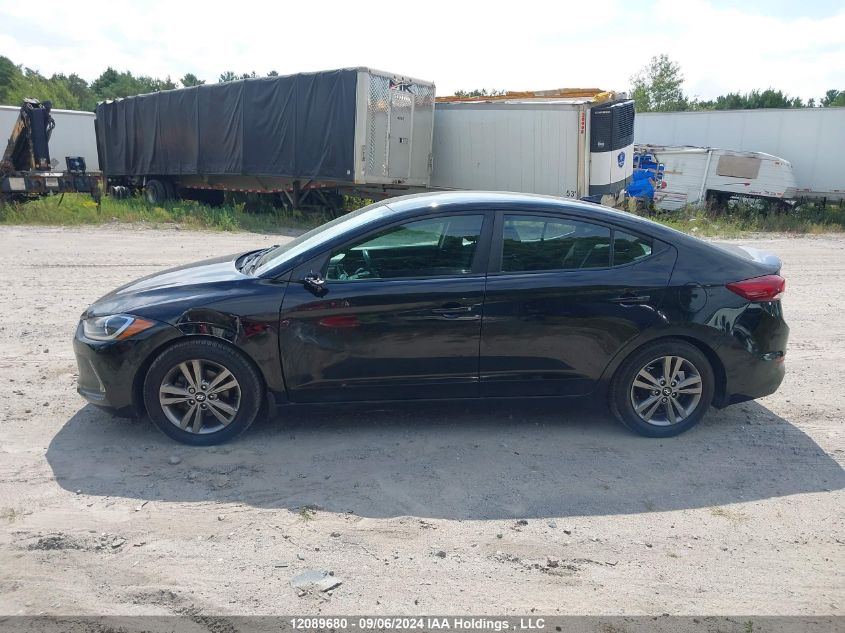 KMHD84LF9HU177101 2017 Hyundai Elantra Gl