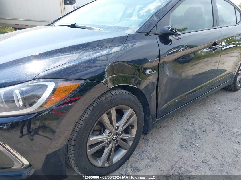 KMHD84LF9HU177101 2017 Hyundai Elantra Gl