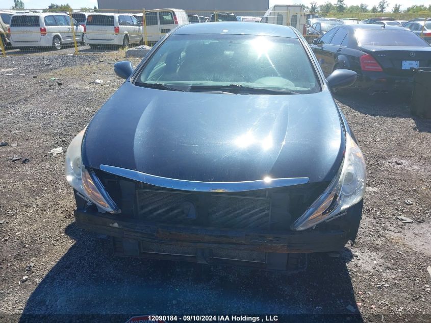 2013 Hyundai Sonata Gls VIN: 5NPEB4AC9DH787703 Lot: 12090184