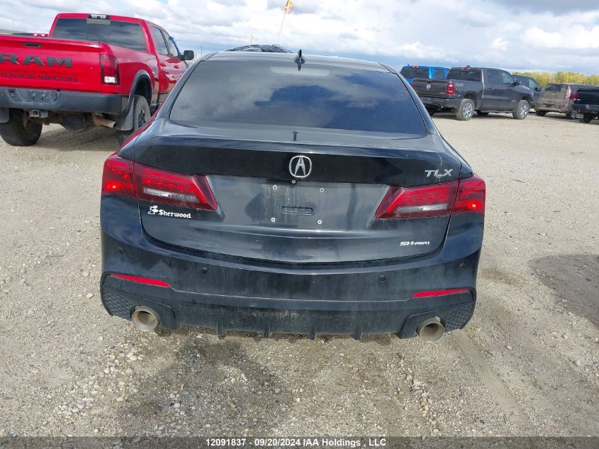 2015 Acura Tlx Tech VIN: 19UUB3F57FA800718 Lot: 12091837