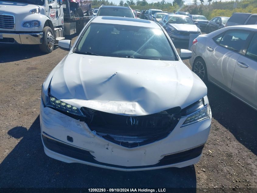 19UUB1F58FA801493 2015 Acura Tlx