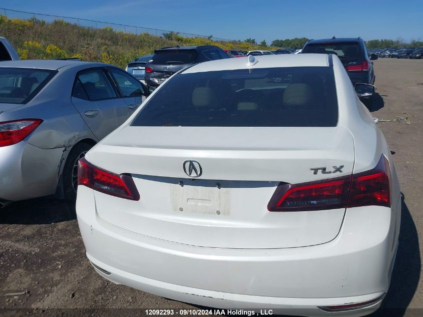 19UUB1F58FA801493 2015 Acura Tlx