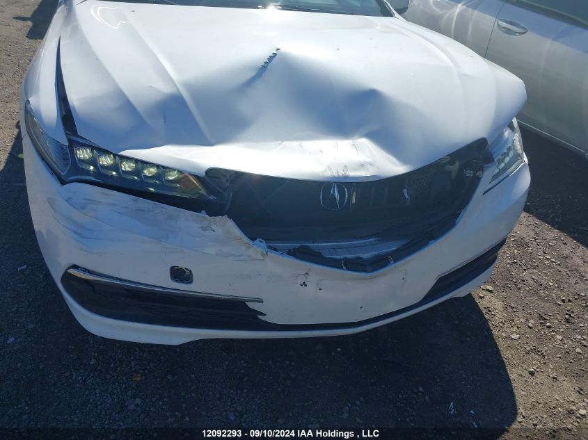 19UUB1F58FA801493 2015 Acura Tlx