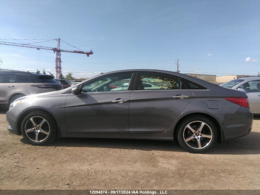 5NPEC4AB4BH174292 2011 Hyundai Sonata