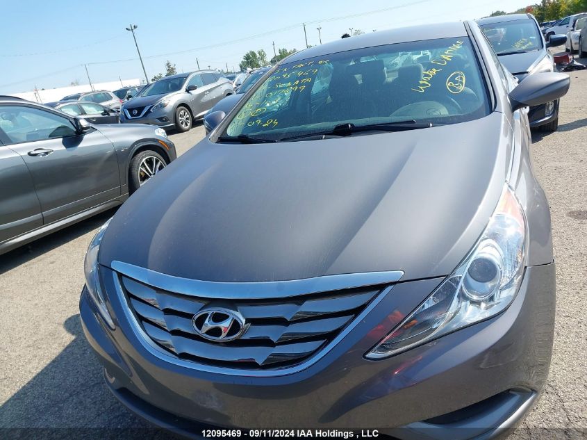 5NPEB4AC7BH017299 2011 Hyundai Sonata