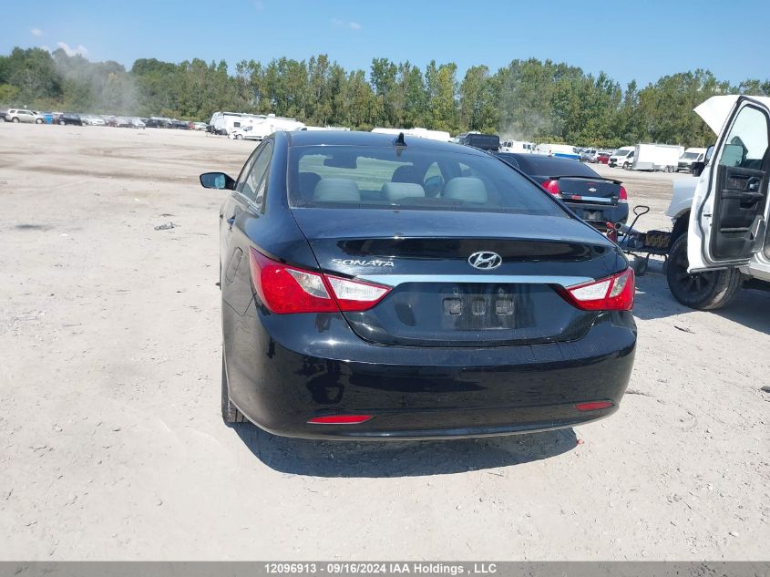 5NPEB4AC2DH719534 2013 Hyundai Sonata Gls