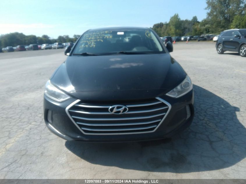 KMHD84LFXJU635198 2018 Hyundai Elantra Gl