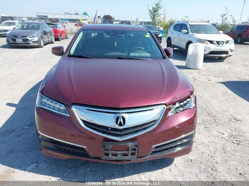 2015 Acura Tlx VIN: 19UUB3F59FA803524 Lot: 12098594