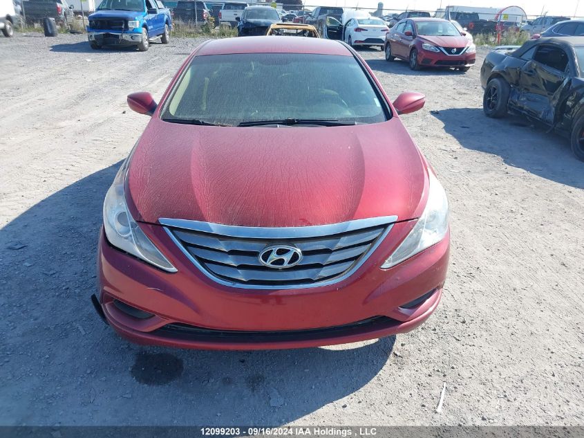 2011 Hyundai Sonata VIN: 5NPEB4AC9BH280944 Lot: 12099203