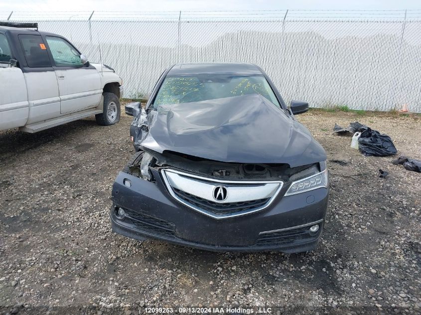 2016 Acura Tlx VIN: 19UUB3F78GA801217 Lot: 12099253