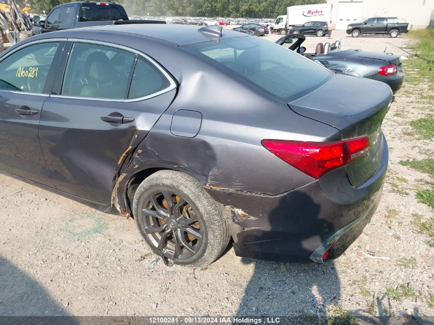 19UUB1F36JA800611 2018 Acura Tlx